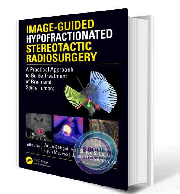 دانلود کتابImage-Guided Hypofractionated Stereotactic Radiosurgery: A Practical Approach to Guide Treatment of Brain and Spine Tumors 1st  (ORIGINAL PDF)